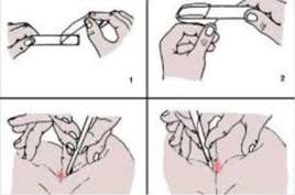 Amprenta anala amprenta-anala