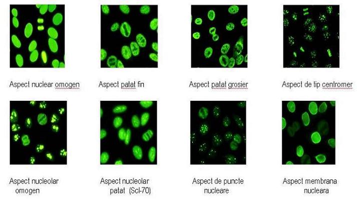 Anticorpi antinucleari (imunofluorescență) - Synevo