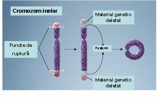 Analiza cromozomială în sânge (cariotip constituțional) - Synevo