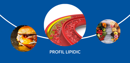 Profil lipidic